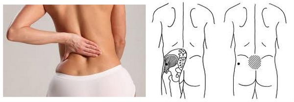Les principales causes de la douleur tirante dans le bas de l'abdomen chez la femme