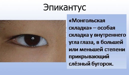Formes des yeux. Comment identifier, photo et description, choisir les flèches, faire un maquillage parfait