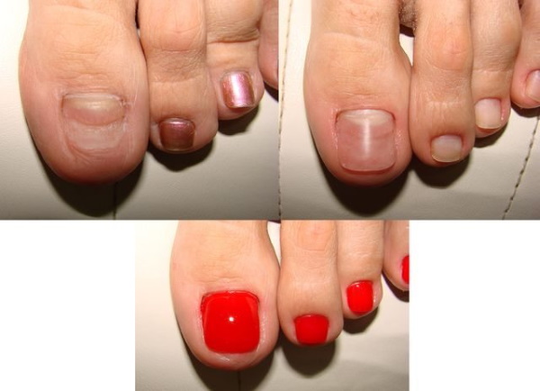 Extension des ongles avec gel, polygel. Photos avant et après, comment faire