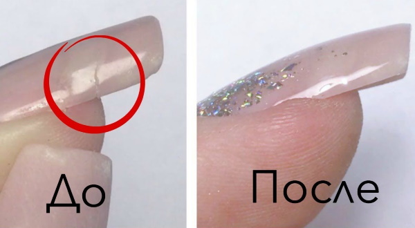 Que faire si un ongle est cassé, comment le fixer sous un vernis gel, prolongé
