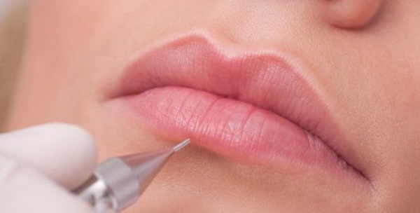 Granulés Fordyce et maquillage permanent des lèvres. Photos avant et après, avis